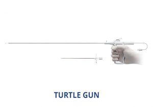 Kyphoplasty system, racz catheter