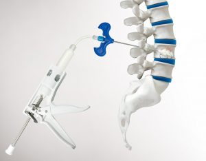 Vertebroplasty device, Spinal stenosis device